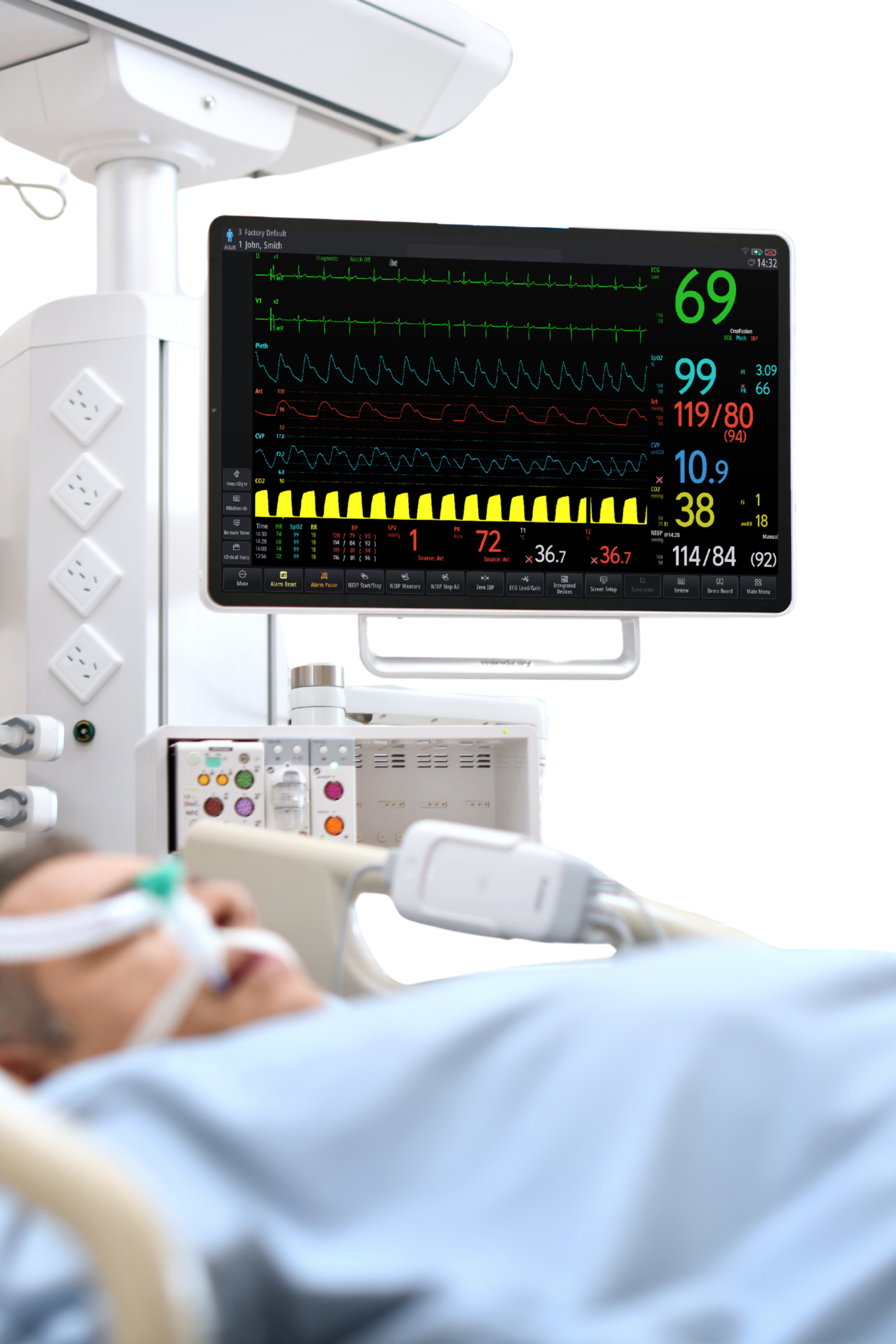 Mindray Benevision V-Serie 