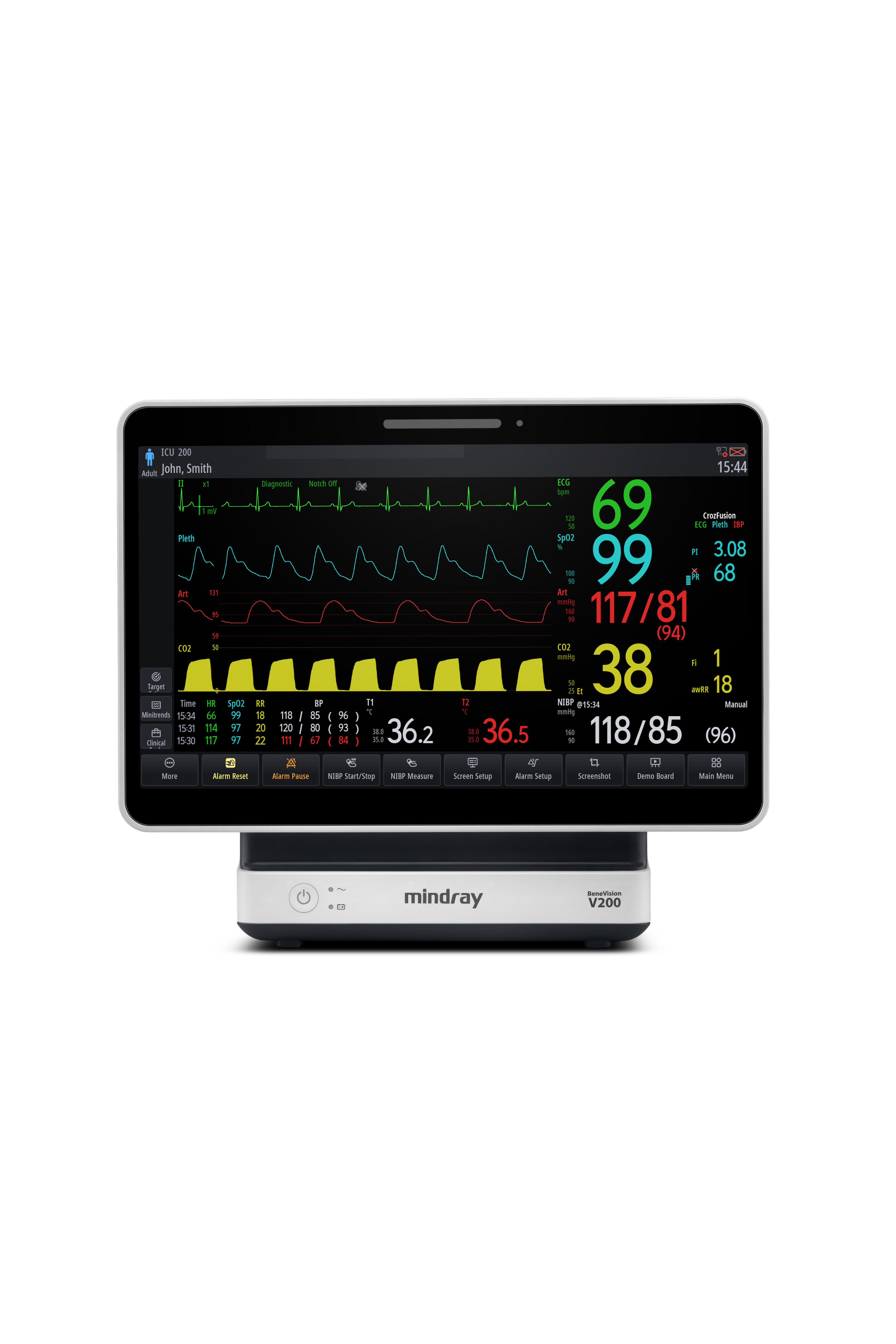 Mindray Benevision V200