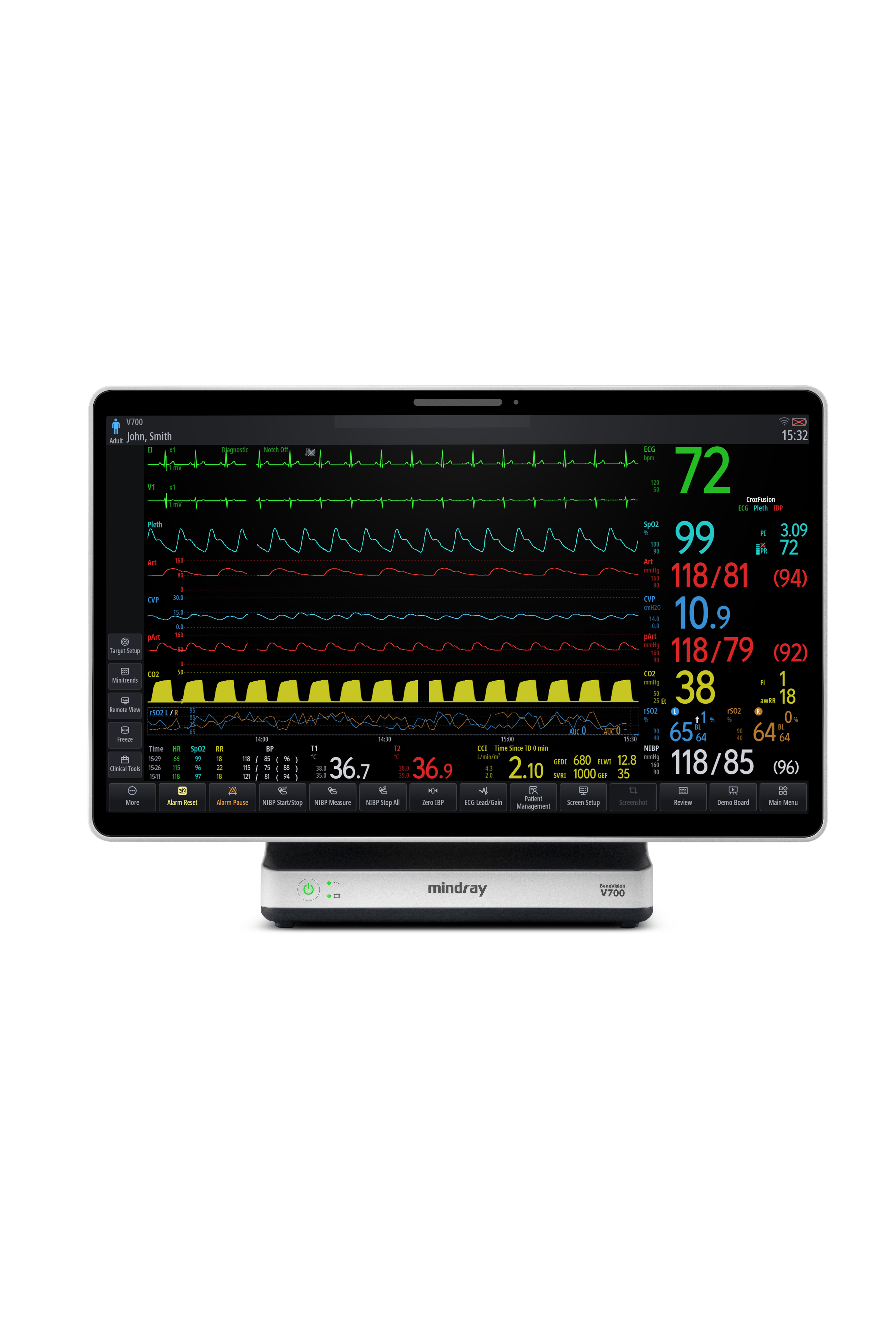 Mindray Benevision V700