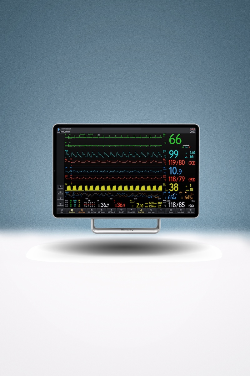 Mindray Benevision V-Serie 