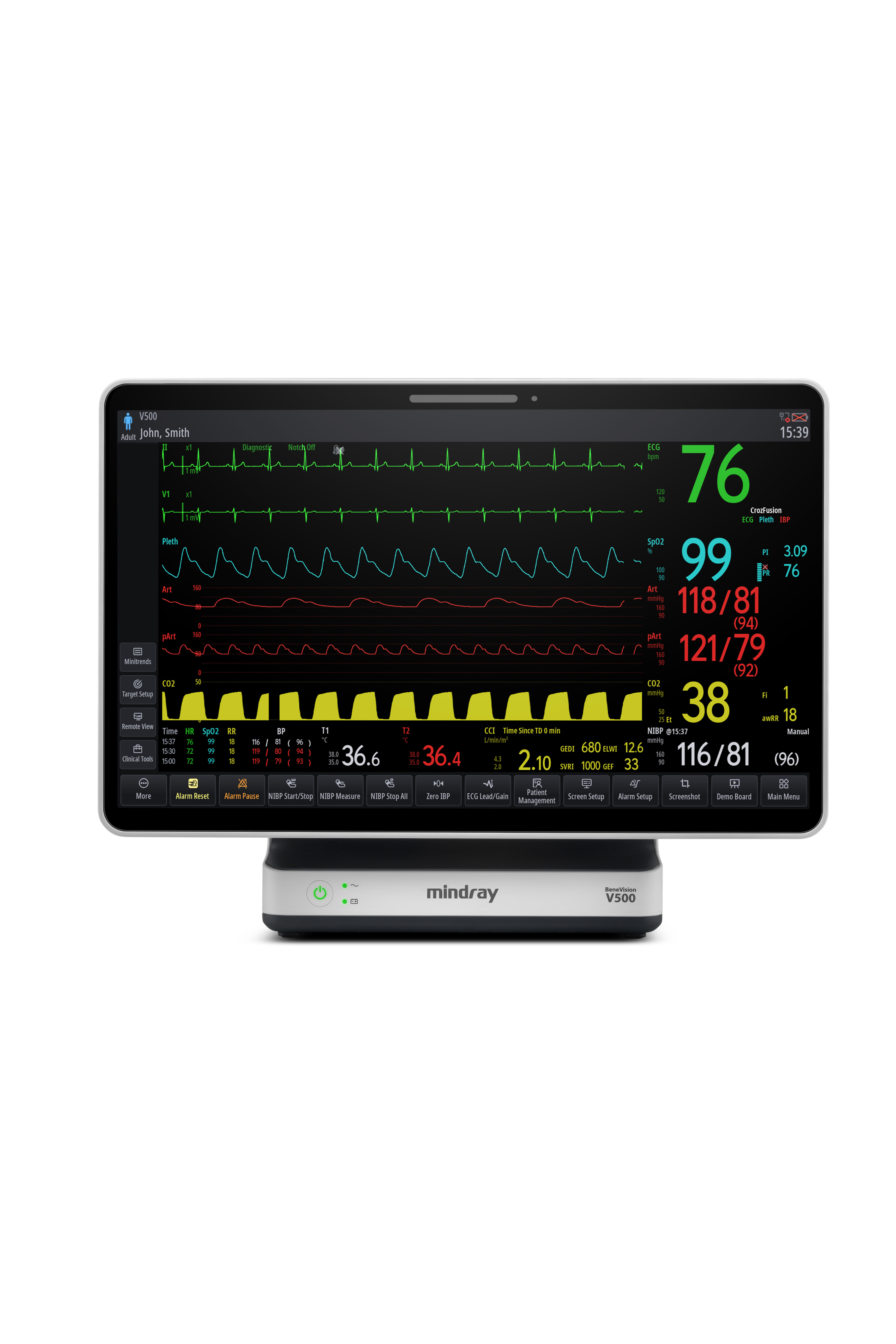 Mindray Benevision V500