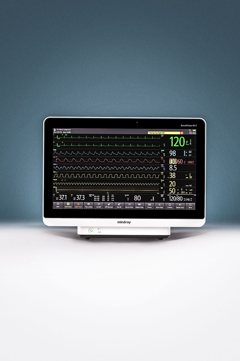 Mindray BeneVision N17
